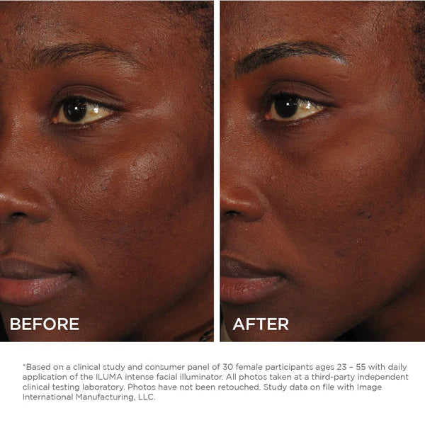 ILUMA Intense Facial Illuminator image 1