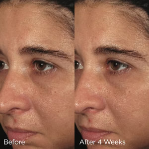 ORMEDIC® Balancing Biopeptide Crème image 2