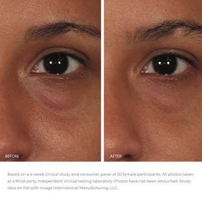 ORMEDIC® Balancing Eye Lift Gel image 2