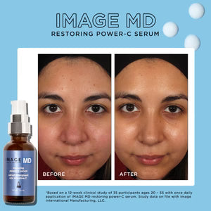 IMAGE MD® restoring power-C serum image 3
